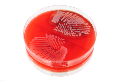 MRSA (Methicillin-Resistant Staphylococcus Aureus) Infection -  Willis-Knighton Health System